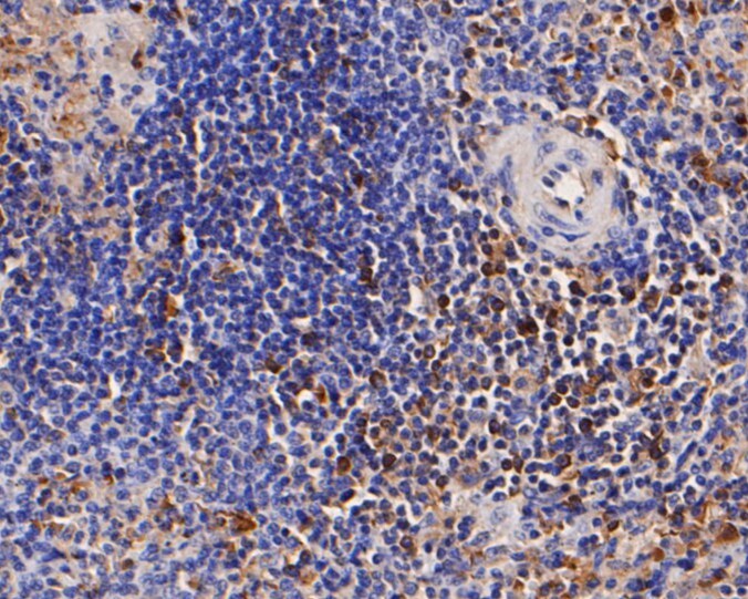 Fig3: Immunohistochemical analysis of paraffin-embedded human spleen tissue using anti-CD68 antibody. The section was pre-treated using heat mediated antigen retrieval with Tris-EDTA buffer (pH 8.0-8.4) for 20 minutes.The tissues were blocked in 5% BSA for 30 minutes at room temperature, washed with ddH2O and PBS, and then probed with the primary antibody ( 1/50) for 30 minutes at room temperature. The detection was performed using an HRP conjugated compact polymer system. DAB was used as the chromogen. Tissues were counterstained with hematoxylin and mounted with DPX.