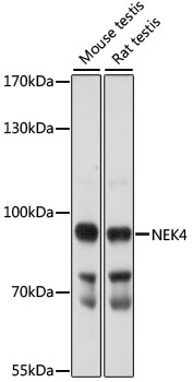 Western blot - NEK4 Polyclonal Antibody 