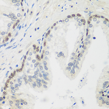 Immunohistochemistry - MDC1 Polyclonal Antibody 