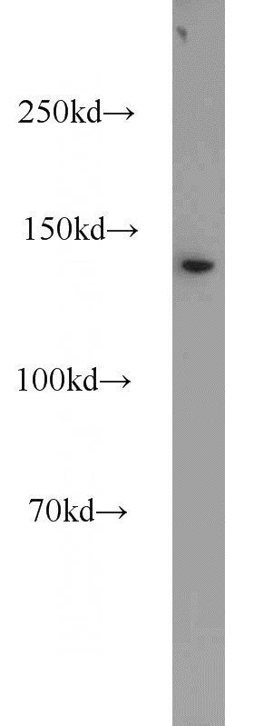 HeLa cells were subjected to SDS PAGE followed by western blot with Catalog No:109933(DHX38 antibody) at dilution of 1:1000