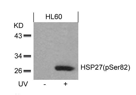 Western blot analysis of extracts from HL60 cells untreated or treated with UV using HSP27 (Phospho-Ser82) Antibody .