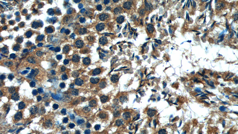 Immunohistochemistry of paraffin-embedded mouse testis tissue slide using Catalog No:108621(C19orf36 Antibody) at dilution of 1:50 (under 40x lens)