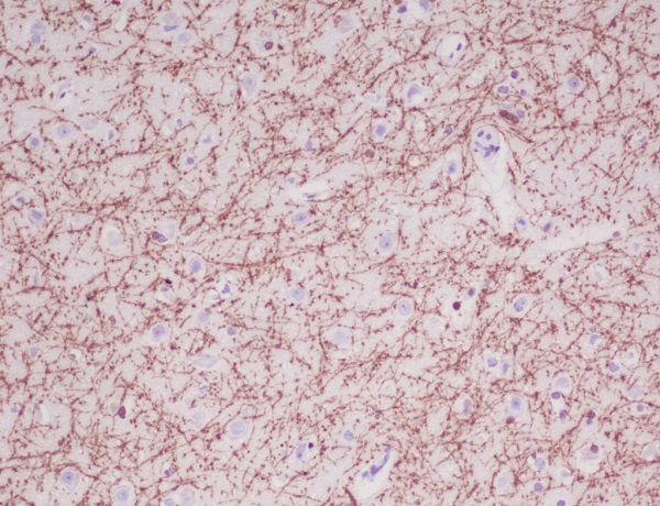 Immunohistochemical analysis of paraffin-embedded human brain, using Myelin Basic Protein Antibody.