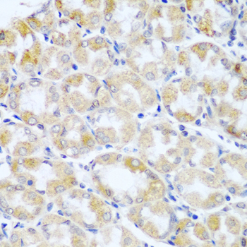 Immunohistochemistry - ANKRD52 Polyclonal Antibody 