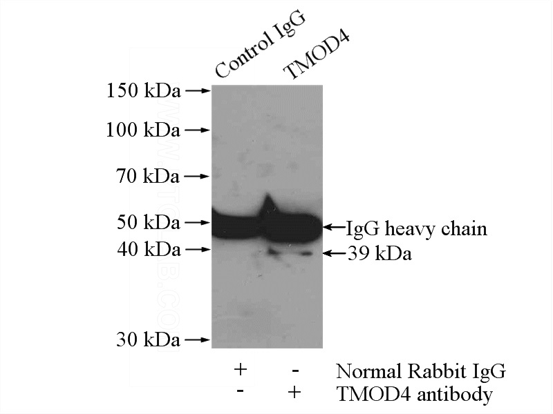 IP Result of anti-TMOD4 (IP:Catalog No:116272, 4ug; Detection:Catalog No:116272 1:600) with mouse skeletal muscle tissue lysate 3600ug.