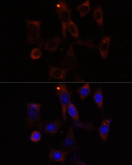 Immunofluorescence - YTHDC2 Polyclonal Antibody 