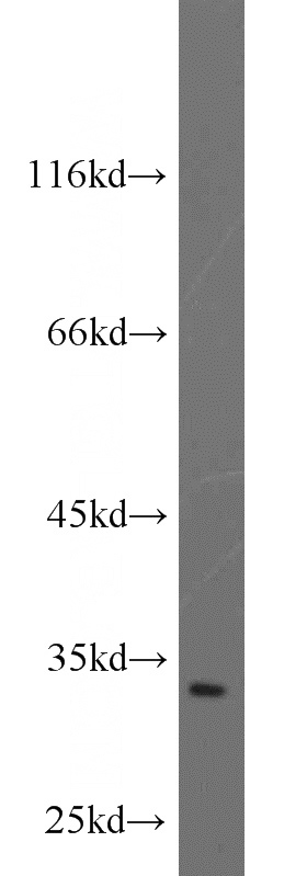 HEK-293 cells were subjected to SDS PAGE followed by western blot with Catalog No:115322(SLC25A11 antibody) at dilution of 1:1000