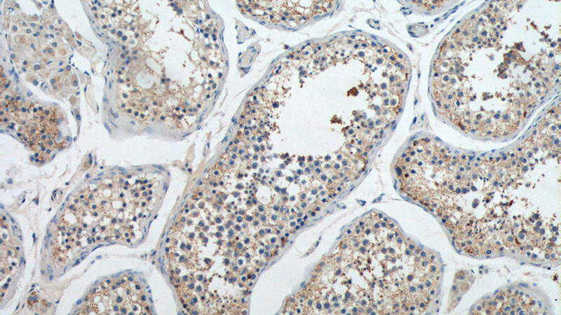 Immunohistochemistry of paraffin-embedded human testis tissue slide using Catalog No:113842(PIWIL2 Antibody) at dilution of 1:50 (under 10x lens)