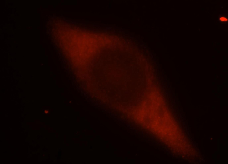 Immunofluorescent analysis of MCF-7 cells, using PABPC1 antibody Catalog No:113474 at 1:25 dilution and Rhodamine-labeled goat anti-rabbit IgG (red).