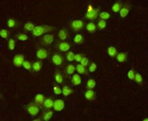 Immunocytochemistry staining of HeLa cells fixed with -20u2103 Methanol and using anti-RPA32/RPA2 antibody (dilution 1:200).