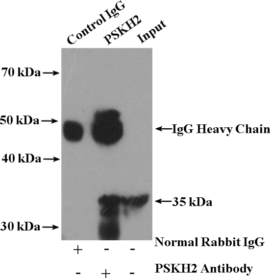 IP Result of anti-PSKH2 (IP:Catalog No:114370, 4ug; Detection:Catalog No:114370 1:500) with HepG2 cells lysate 3400ug.