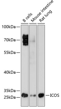 Western blot - ICOS Polyclonal Antibody 