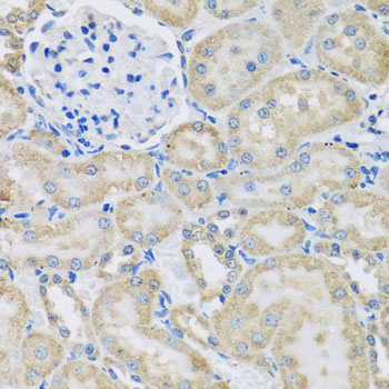 Immunohistochemistry - DCP2 Polyclonal Antibody 