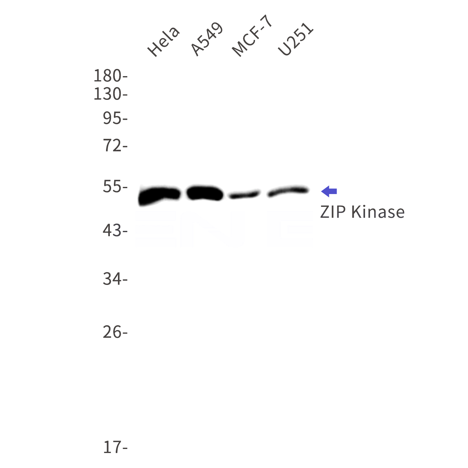 Western blot detection of ZIP Kinase in Hela,A549,MCF-7,U251 cell lysates using ZIP Kinase Rabbit mAb(1:1000 diluted).Predicted band size:53kDa.Observed band size:53kDa.