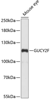Western blot - GUCY2F Polyclonal Antibody 