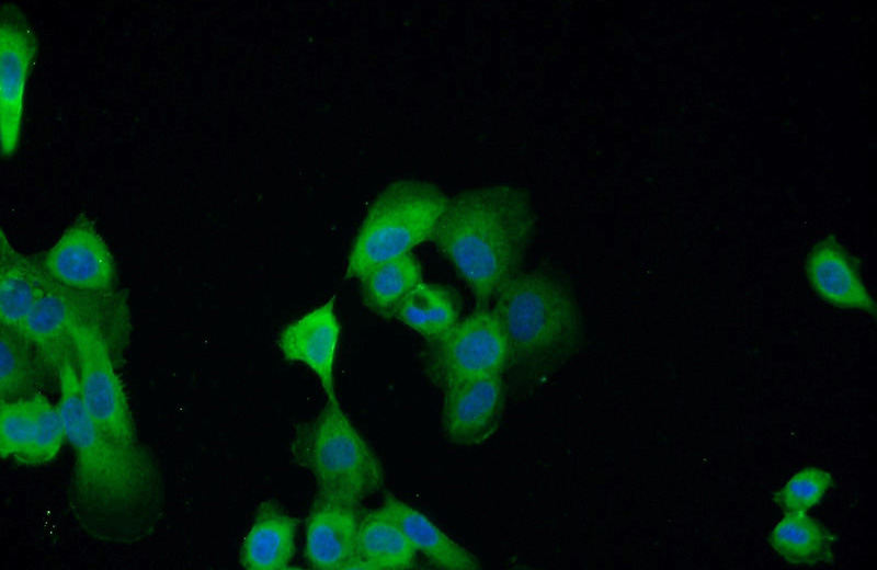Immunofluorescent analysis of A431 cells using Catalog No:107229(KRT14 Antibody) at dilution of 1:50 and Alexa Fluor 488-congugated AffiniPure Goat Anti-Mouse IgG(H+L)