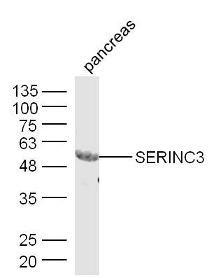 Fig1: Sample: Pancreas (Mouse) Lysate at 40 ug; Primary: Anti-SERINC3 at 1/300 dilution; Secondary: IRDye800CW Goat Anti-Rabbit IgG at 1/20000 dilution; Predicted band size: 53 kD; Observed band size: 53 kD