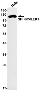 Western blot detection of SPINK5/LEKTI in Hela cell lysates using SPINK5/LEKTI Rabbit mAb(1:500 diluted).Predicted band size:121kDa.Observed band size:121kDa.