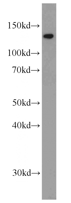 mouse brain tissue were subjected to SDS PAGE followed by western blot with Catalog No:108954(DBC1 antibody) at dilution of 1:1000