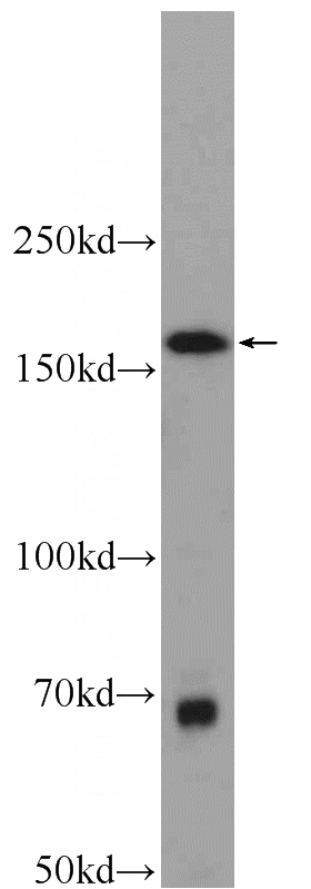 COLO 320 cells were subjected to SDS PAGE followed by western blot with Catalog No:115055(SAMD9L Antibody) at dilution of 1:1000
