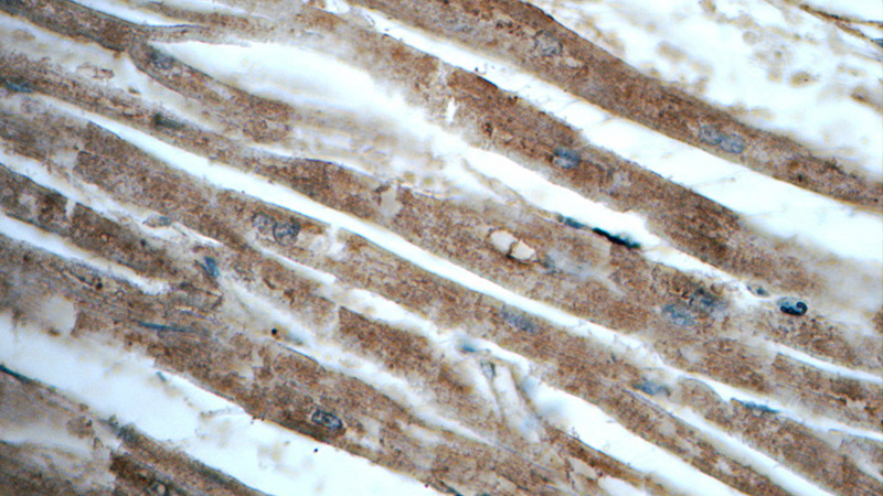 Immunohistochemistry of paraffin-embedded human heart tissue slide using Catalog No:109211(CHCHD10 Antibody) at dilution of 1:50 (under 40x lens)