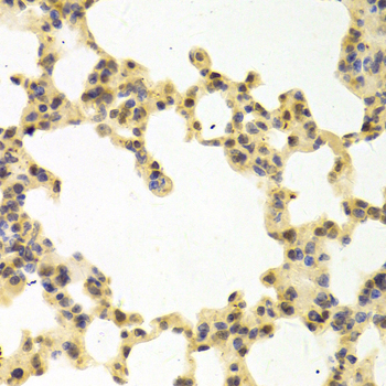 Immunohistochemistry - RANGAP1 Polyclonal Antibody 