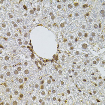 Immunohistochemistry - PPP2R5C Polyclonal Antibody 