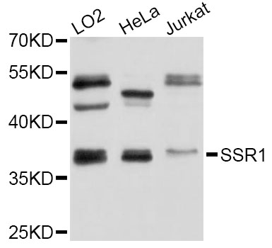 Western blot - SSR1 Polyclonal Antibody 