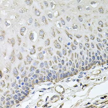 Immunohistochemistry - RHOT1 Polyclonal Antibody 