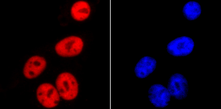 Fig3: ICC staining SMC3 in HepG2 cells (red). The nuclear counter stain is DAPI (blue). Cells were fixed in paraformaldehyde, permeabilised with 0.25% Triton X100/PBS.