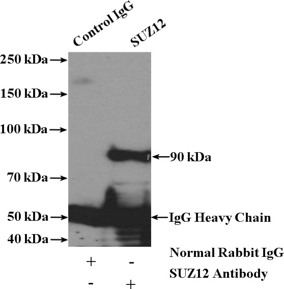 IP Result of anti-SUZ12 (IP:Catalog No:115753, 4ug; Detection:Catalog No:115753 1:500) with HeLa cells lysate 3200ug.