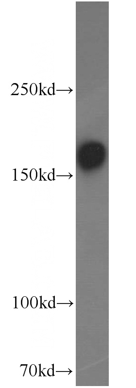 mouse brain tissue were subjected to SDS PAGE followed by western blot with Catalog No:113235(GRIN2B antibody) at dilution of 1:5000