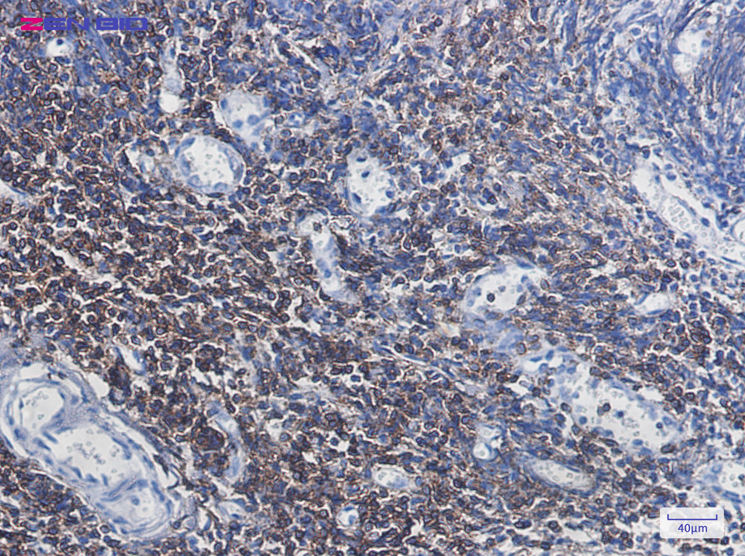 Immunohistochemistry of CD3G in paraffin-embedded Human tonsil using CD3G Rabbit pAb at dilution 1/50