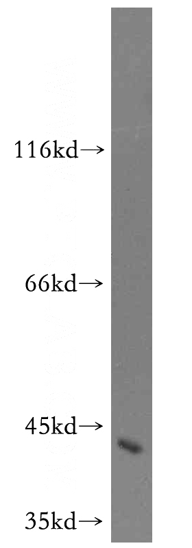 mouse brain tissue were subjected to SDS PAGE followed by western blot with Catalog No:113051(ND2 antibody) at dilution of 1:300