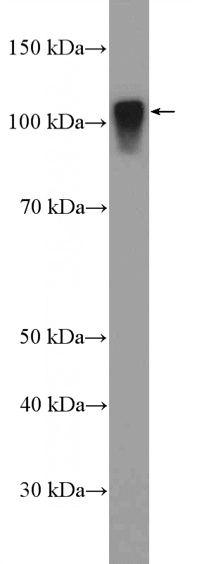 rat liver tissue were subjected to SDS PAGE followed by western blot with Catalog No:115070(SARDH Antibody) at dilution of 1:1500