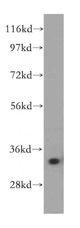 human liver tissue were subjected to SDS PAGE followed by western blot with Catalog No:107939(AKR1B1 antibody) at dilution of 1:500