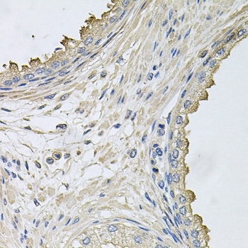 Immunohistochemistry - HERC3 Polyclonal Antibody 