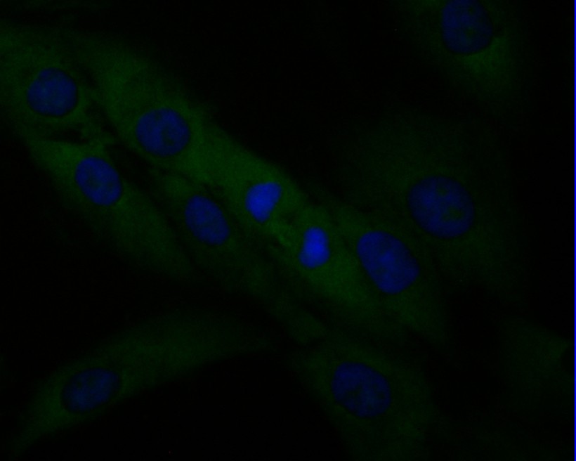 Fig4: ICC staining of SPATA5L1 in MG-63 cells (green). Formalin fixed cells were permeabilized with 0.1% Triton X-100 in TBS for 10 minutes at room temperature and blocked with 1% Blocker BSA for 15 minutes at room temperature. Cells were probed with the primary antibody ( 1/50) for 1 hour at room temperature, washed with PBS. Alexa Fluor®488 Goat anti-Mouse IgG was used as the secondary antibody at 1/1,000 dilution. The nuclear counter stain is DAPI (blue).