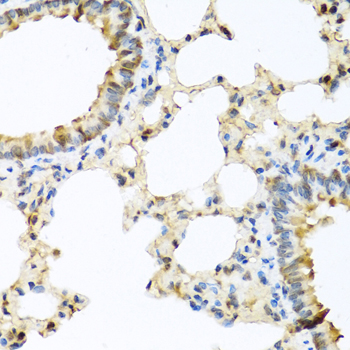 Immunohistochemistry - CCL11 Polyclonal Antibody 