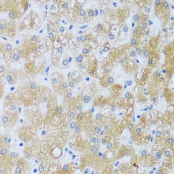 Immunohistochemistry - ASB4 Polyclonal Antibody 