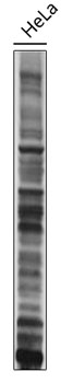 Western blot - Pan Acetyl-Lysine mAb 