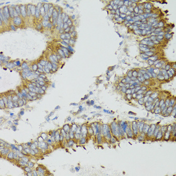 Immunohistochemistry - MT-ND5 Polyclonal Antibody 