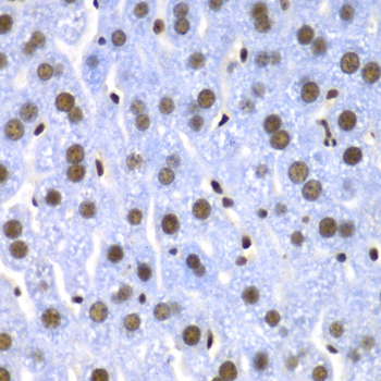 Immunohistochemistry - SF3B2 Polyclonal Antibody 