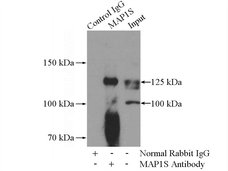 IP Result of anti-MAP1S (IP:Catalog No:112473, 4ug; Detection:Catalog No:112473 1:500) with SH-SY5Y cells lysate 1800ug.