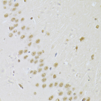 Immunohistochemistry - SNRPA Polyclonal Antibody 