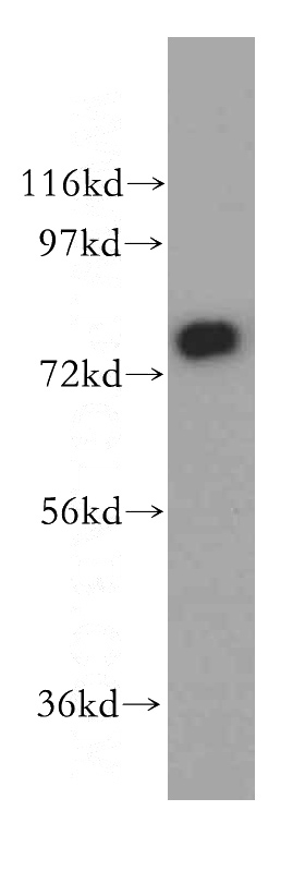 human kidney tissue were subjected to SDS PAGE followed by western blot with Catalog No:115804(SYT17 antibody) at dilution of 1:800