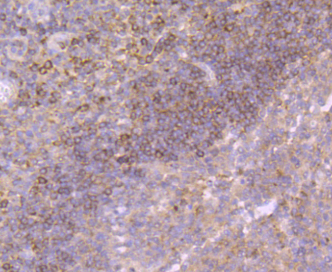 Fig2:; Immunohistochemical analysis of paraffin-embedded human tonsil tissue using anti-Growth Hormone antibody. The section was pre-treated using heat mediated antigen retrieval with Tris-EDTA buffer (pH 9.0) for 20 minutes.The tissues were blocked in 1% BSA for 30 minutes at room temperature, washed with ddH; 2; O and PBS, and then probed with the primary antibody ( 1/50) for 30 minutes at room temperature. The detection was performed using an HRP conjugated compact polymer system. DAB was used as the chromogen. Tissues were counterstained with hematoxylin and mounted with DPX.