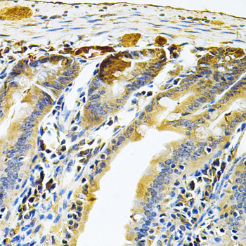 Immunohistochemistry - RRAGC Polyclonal Antibody 