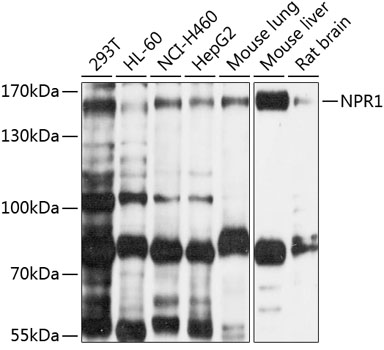 Western blot - NPR1 Polyclonal Antibody 