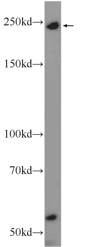 mouse thymus tissue were subjected to SDS PAGE followed by western blot with Catalog No:112988(MYO9B Antibody) at dilution of 1:600